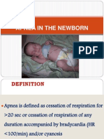 Apnea in The Newborn