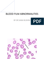 Blood Film Abnormalities