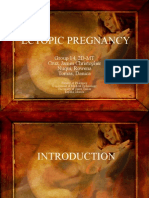 Ectopic Pregnancy