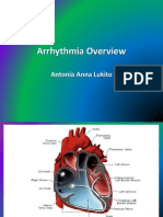 Arrhythmia Overview: Antonia Anna Lukito