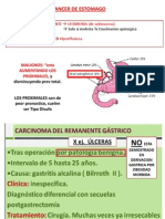 Cancer Gastrico