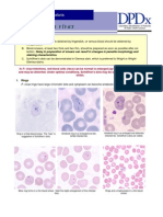 P. Vivax Diagnosis