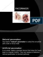 Pacemakers