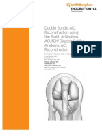 Double Bundle ACL Reconstruction Using The Smith & Nephew ACUFEX™ Director Set For Anatomic ACL Reconstruction