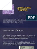 Infecciones Fungicas