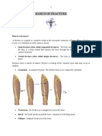 Basics of Fracture