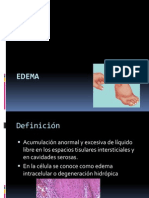 Edema