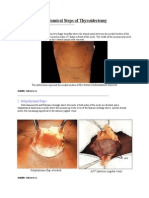 Anatomical Steps of Thyroidectomy