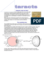 Cataracts: What Are They?