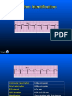 Practice ECGStrips