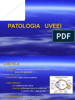 Uveite, Cataracte Glaucomul