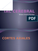 Tac Cerebral