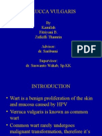 VERUCCA VULGARIS Presentation