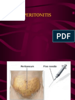 Peritonitis