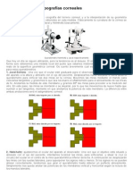 Interpretación de Topografías Corneales