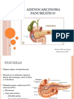 Adenocarcinoma Pancreático