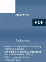 Atelectasis