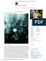 Síndrome Do Intestino Permeável. A Epidemia Do Séc. Xxi. - DR