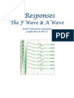 F Waves