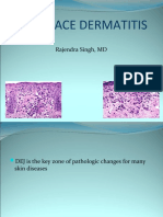 Interface Dermatitis: Rajendra Singh, MD