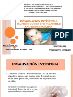 Invaginación Intestinal