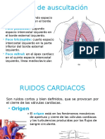 Focos de Auscultación