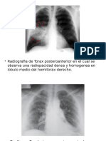 Radiografias