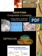 Odontoma