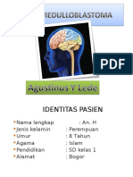 Case Medulloblastoma