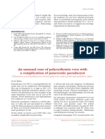 An Unusual Case of Polycythemia Vera With A Complication of Pancreatic Pseudocyst