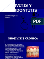 Gingivitis Cronica