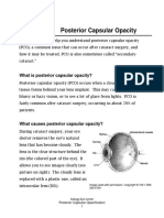 Posterior Capsular Opacity