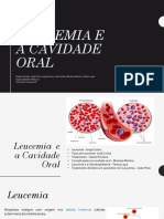 Leucemia e A Cavidade Oral