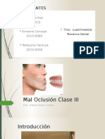 Maloclusion Clase 3