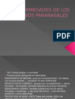 Enfermedades de Los Senos Paranasales