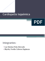 Cardiopatía Isquémica