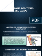 Sindrome Del Túnel Del Carpo