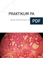 Praktikum Pa Neoplasia Na