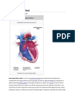 Congenital Heart Disease