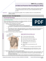 Right Side Ecg