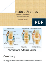 Rheumatoid Arthritis: Department of Internal Medicine Samuel Asselo Murano Year VI Wednesday, 5 April 2017