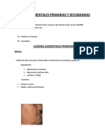 Lesiones Elementales Primarias y Secundarias