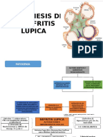 Patogénesis de La Nefritis Lúpica