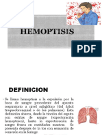 Hemoptisis