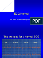 04 ECG Normal