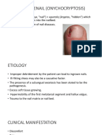 Ingrown Toenail (Onychocryptosis)