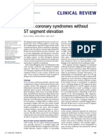 ACS ST Elevation