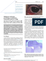 Malignant Melanoma Presenting As Amelanotic Caruncular Lesion in A Child