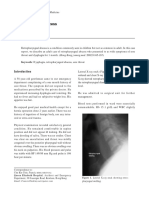 Retropharyngeal Abscess