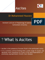 Ascites: DR Mohammed Hussien